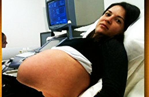 Daniela Nogueira de Oliveira, de 25 anos, grávida de nove meses, teve morte cerebral dois dias depois do crime (Reprodução/Facebook)