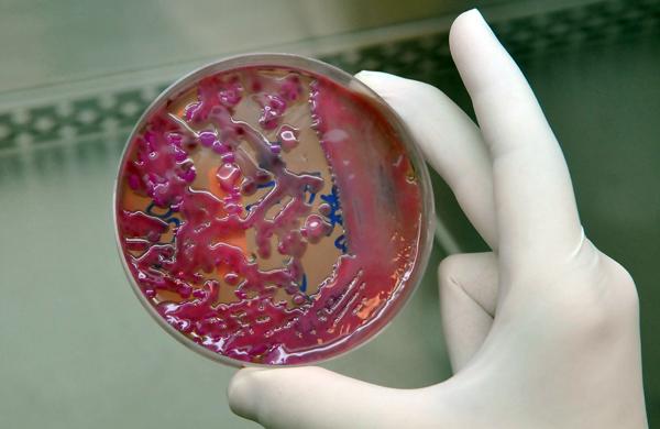 Origem da bactéria é investigada pela Comissão de Controle de Infecção do Hospital de Clínicas (Cesar Rodrigues/AAN)