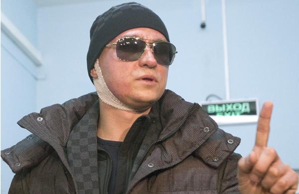 Diretor artístico do Bolshoi, Serguei Filin, deixa hospital com o rosto ainda queimado pelo ácido (France Press)