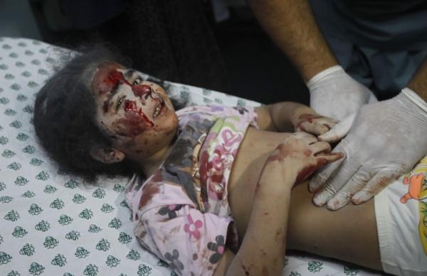 Crian&ccedil;a palestina &eacute; atendida depois de ser gravemente machucada por ataque israelense  (AFP)