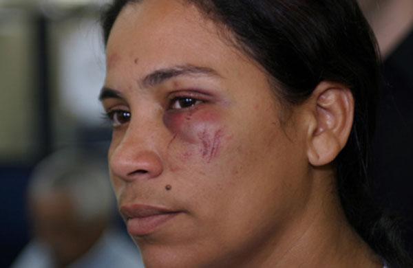 Sirley Dias de Carvalho Pinto, empregada, agredida ( Cedoc/RAC)