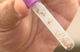 S&ograve; nesta semana, a Vigil&acirc;ncia Epidemiol&oacute;gica recebeu 15 notifica&ccedil;&otilde;es ( Reprodução)