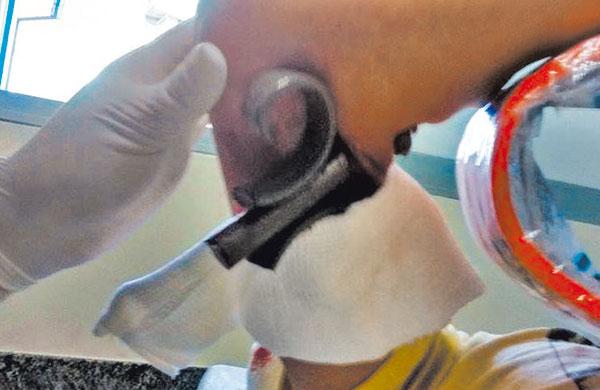 Bombeiros n&atilde;o souberam dizer se a v&iacute;tima tentava pular o port&atilde;o ou se apenas escorregou (Divulgação)