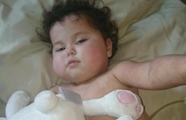 Beb&ecirc; Sofia, que tem s&iacute;ndrome rara, volta para a UTI de hospital em Miami ( Reprodução/ Facebook)