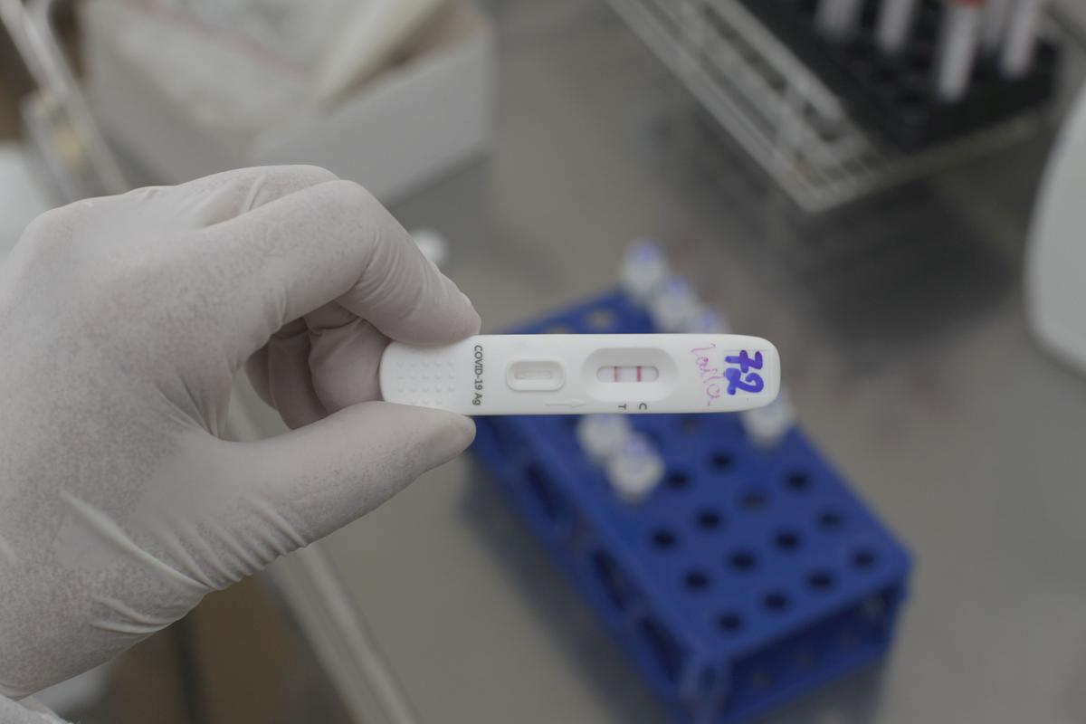No início de junho o índice de positividade nos testes estava em 33,2%: tendência de queda deverá se manter (Ricardo Lima)