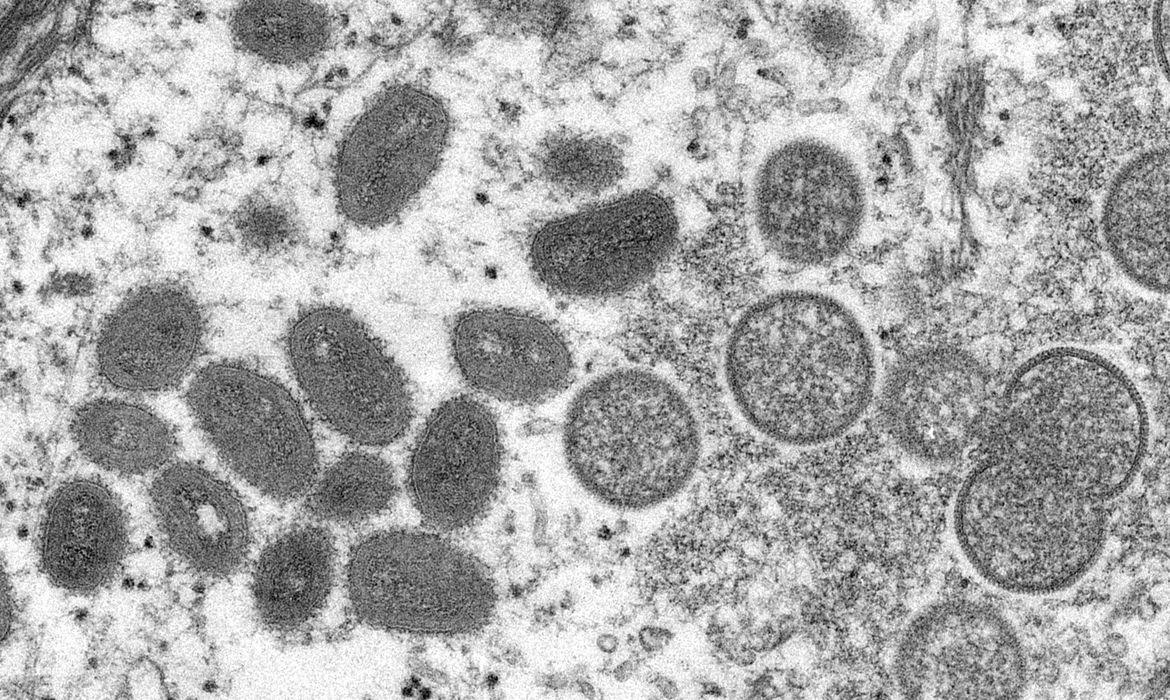 Atualização dos casos de varíola dos macacos em Campinas (Cynthia S. Goldsmith)