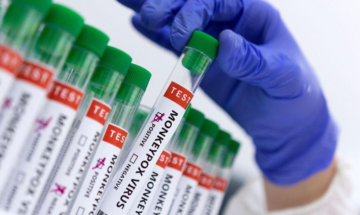 Secretaria de Saúde confirma mais um caso de monkeypox na cidade (Divulgação)