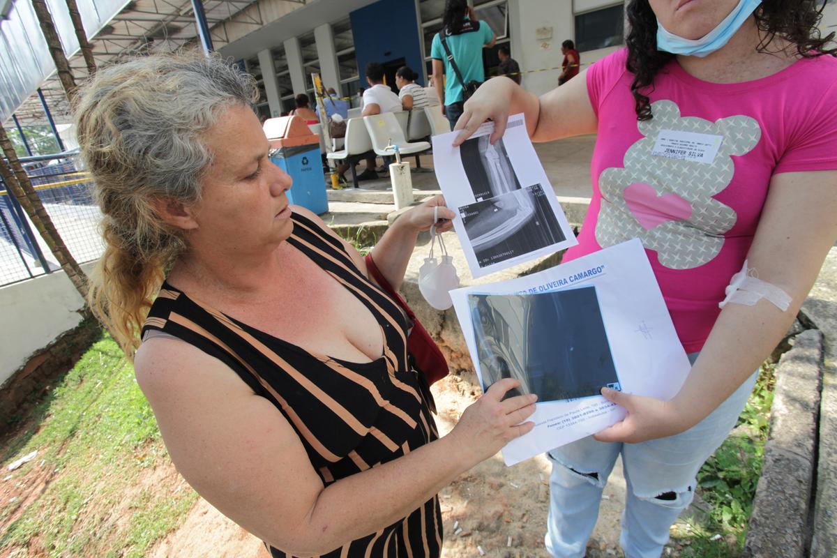 A mãe da adolescente está muito indignada com o caso e mostra os raios-x do projétil no braço da filha (Rodrigo Zanotto)