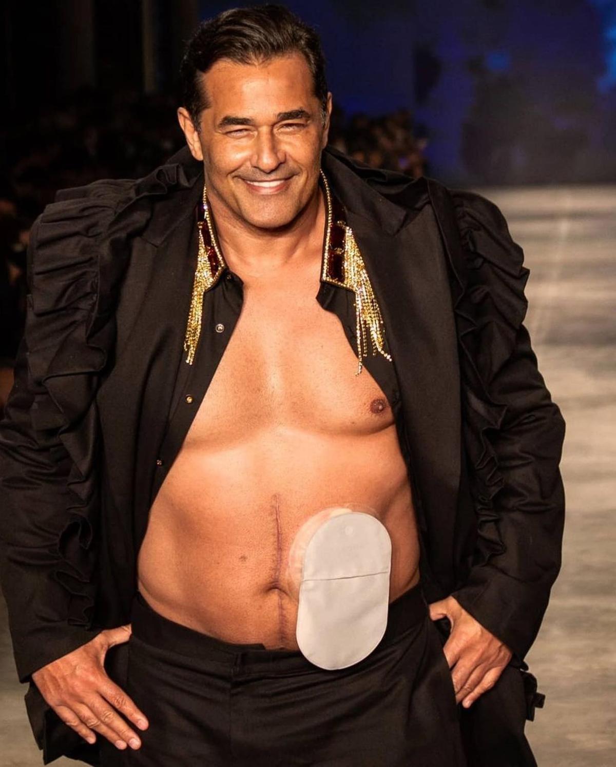 Tanto em seu novo programa quanto na passarela, Szafir se sente realizado e coleciona momentos especiais; o desfile na SPFW, há um ano, com a bolsa de colostomia se destacando teve um apelo social, repercutiu positivamente e gerou muita (Reprodução Instagram)