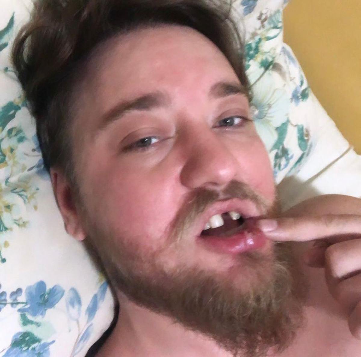 Empresário afirma que foi espancado por um segurança da Pink Elephant, resultando na perda de um dente (Divulgação)