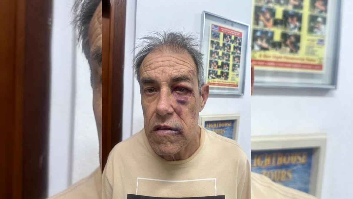 Sérgio Tresoldi, de 65 anos, foi agredido com socos em Sousas (Polícia Civil)