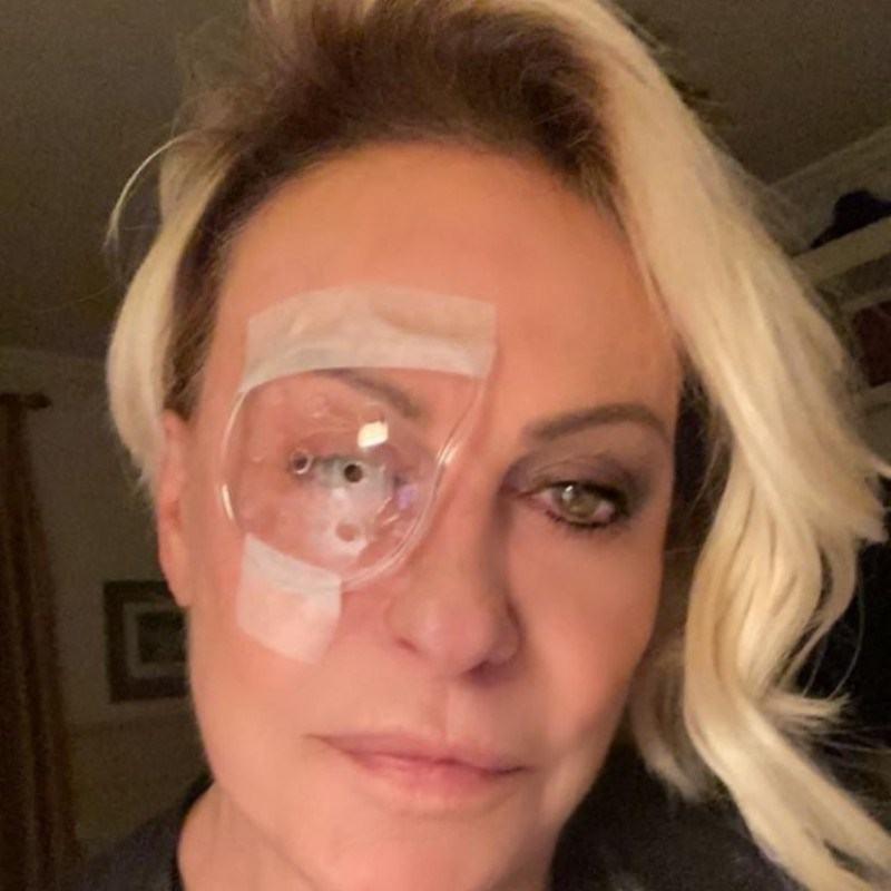 "Foi catarata, mas estou completamente recuperada, viu? Eu achava que catarata era uma coisa de outro mundo, mas olha, é uma cirurgia de 15 ou 20 minutos. Parece um milagre mesmo!", escreveu (Reprodução/ Instagram)