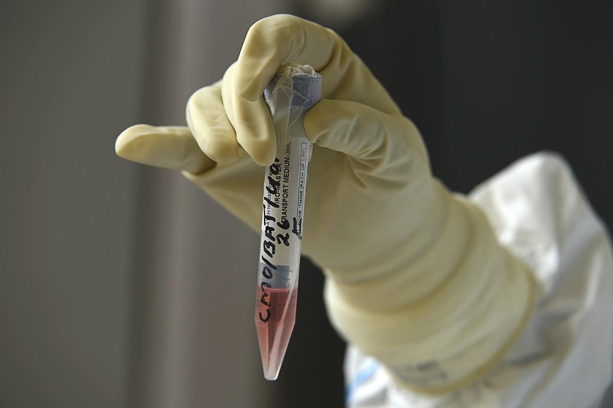 Campinas registrou 582 novos casos de contaminação por coronavírus e duas novas mortas nesta segunda-feira (27) (Divulgação)