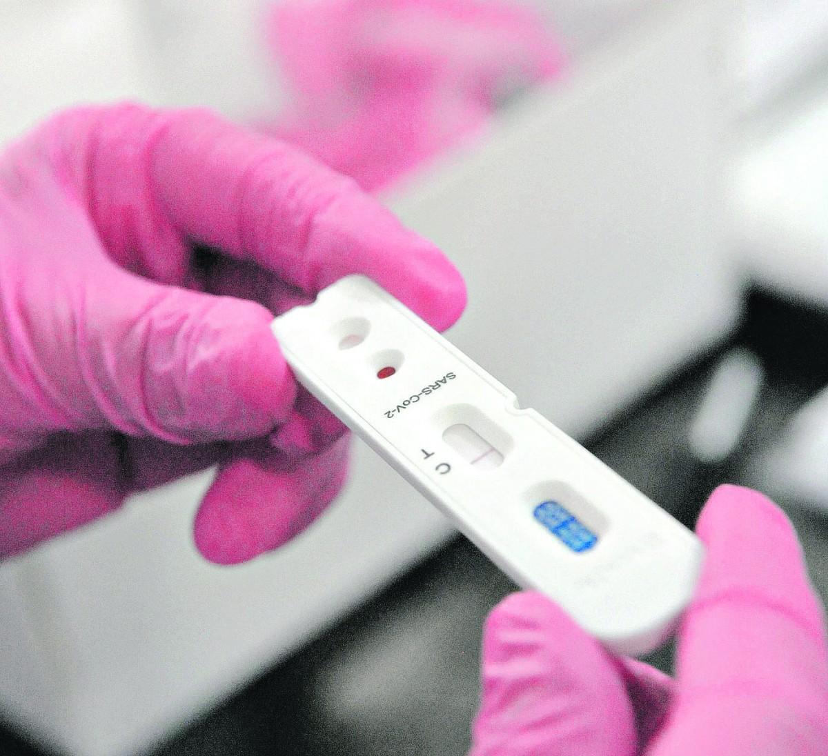A Anvisa alerta que resultado positivo dos testes não serve na contagem de casos no País, porque há a possibilidade de falso negativo (Matheus Pereira/AAN)