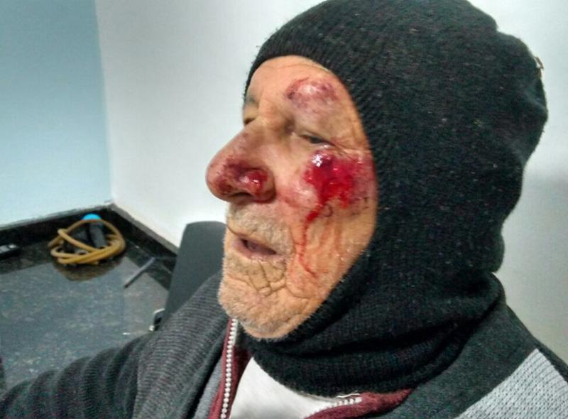A família contou que o aposentado fazia a sua caminhada rotina, às 7h da manhã, quando foi abordado por um homem que o agrediu sem explicar o motivo ou ser provocado (Reprodução)