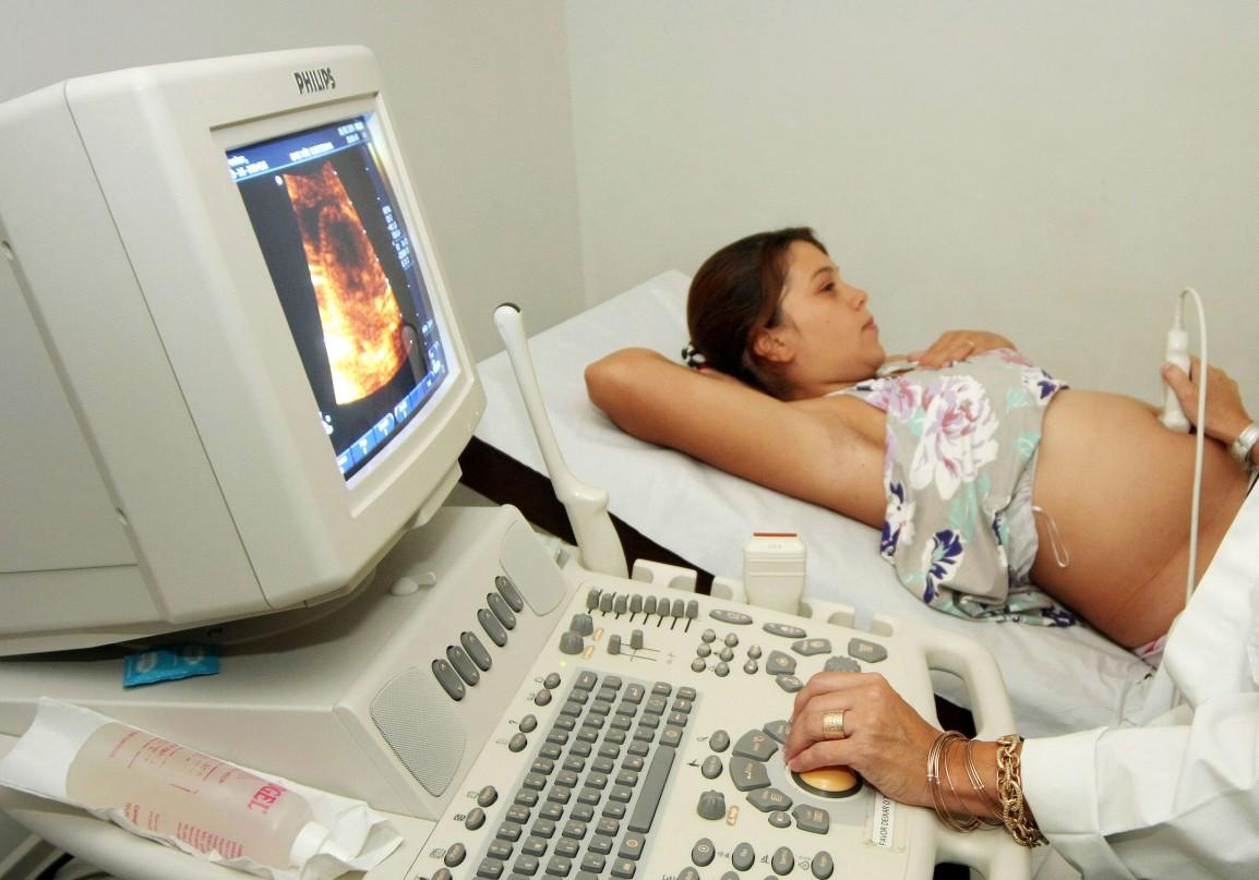 Mulheres gr&aacute;vidas vivem momentos de tens&atilde;o durante a gesta&ccedil;&atilde;o: s&oacute; no Nordeste foram registrados at&eacute; agora 739 beb&ecirc;s com microcefalia  ( Ag&ecirc;ncia Brasil )
