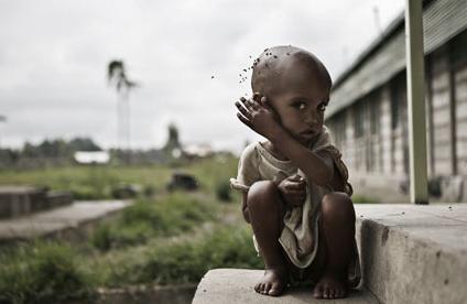 Crian&ccedil;a subnutrida na Eti&oacute;pia, na &Aacute;frica  (AFP)