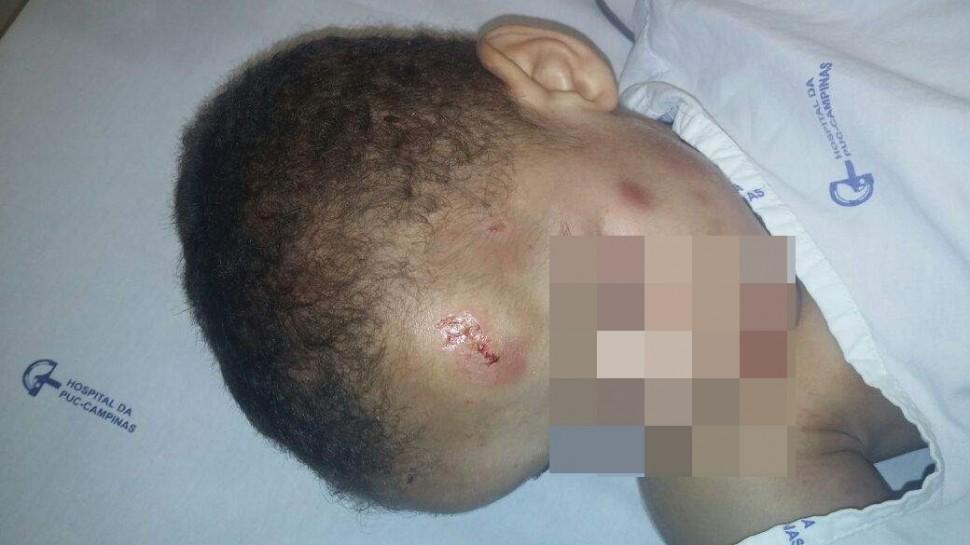 Menino, resgatado, sinais de viol&ecirc;ncia ( Divulgação)
