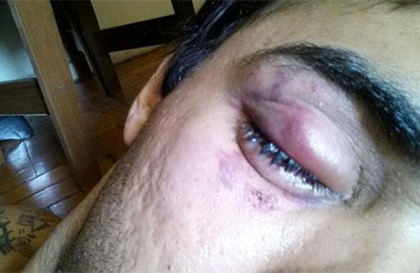 Ator Maxie Maya, de 29 anos, foi agredido no centro do Rio quando voltava para casa de uma festa destinada ao p&uacute;blico LGBT (Reprodução/ Twitter)