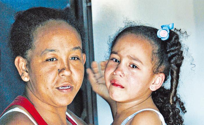 Marlene da Silva e a filha Maria Luiza foram picadas pelo mesmo escorpi&atilde;o (Cristiano Diehi Neto)