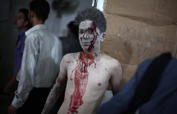 Garoto fica ferido ap&oacute;s bombardeio no norte de Damasco  (AFP)