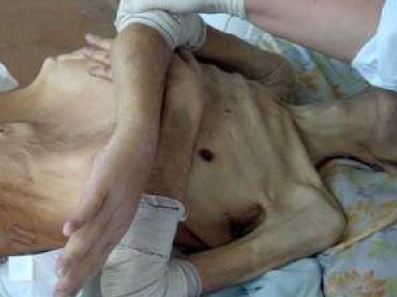 Carlos Donizete da Silva, de 56 anos, morreu por desidrata&ccedil;&atilde;o e desnutri&ccedil;&atilde;o ( Divulgação)