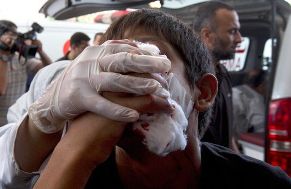 M&eacute;dico palestino atende pessoa ferida na faixa de Cidade de Gaza (AFP)
