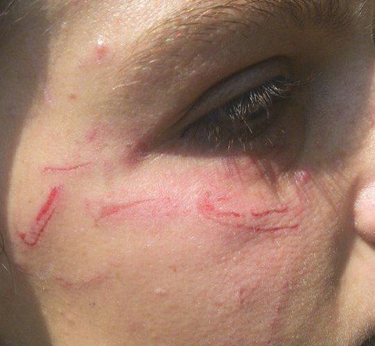 Estudante teve o rosto arranhado e cabelo cortado dentro de sala de aula em escola estadual (Carlos Gomide/Divulgação)