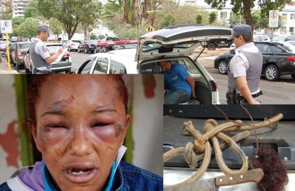 Marido usou cordas para amarrar a vítima, que ficou com o rosto deformado (Charles Caleb / Ata News)